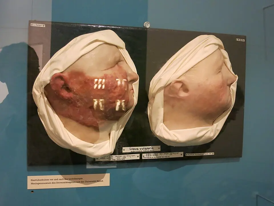 Moulagenmuseum